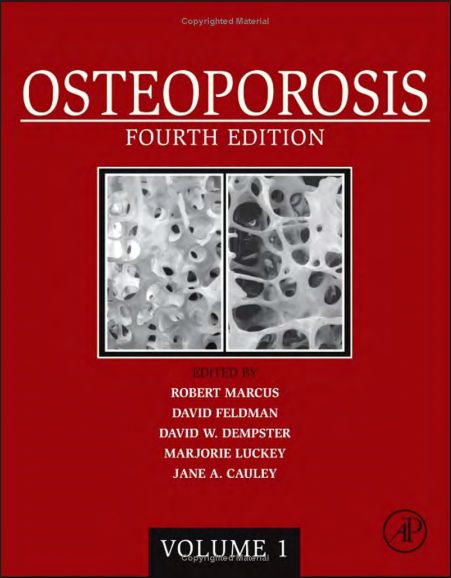 thesis on osteoporosis pdf